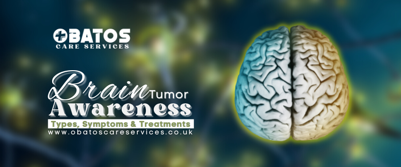 Brain Tumor Awareness : Types, Causes, Symptons, Diagnosis & Treatments